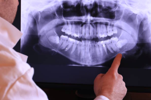 Best Emergency Dental Extractions in Blackshear, GA
